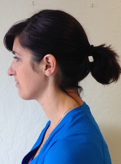 side profile of patient