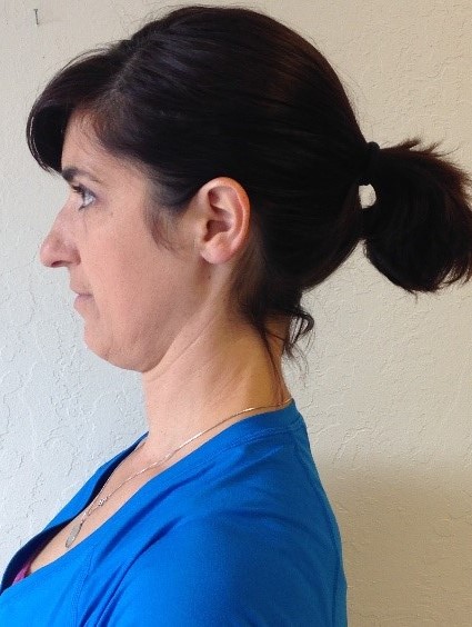 side profile of patient
